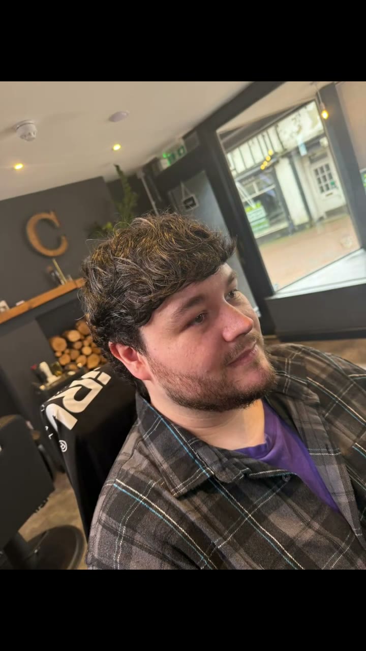 After: a full head of hair following a men's system